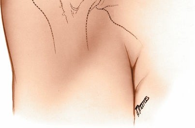 Illustration 90 for Essential Guide: Mastering Every Approach to the Shoulder