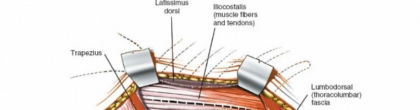 Illustration 401 for Approach to the Lumbar Spine: Mastering Techniques & Anatomy