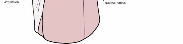 Illustration 118 for Mastering Knee Approaches: Spotlight on Superficial Medial Ligament