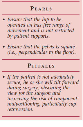 Illustration of figure posterior approach - Dr. Mohammed Hutaif