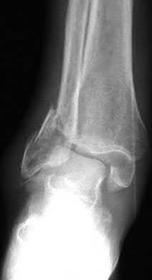 Illustration 29 for OrthoCash: Trauma MCQs & Cases for a yearold woman