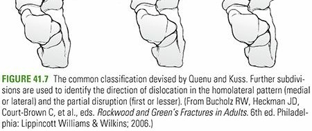 Illustration 21 for Mastering First MTP Joint & Forefoot Fractures: A Comprehensive Guide
