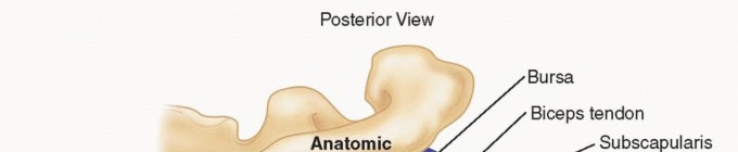 Glenoid Bone Graft: Repair Bone Loss, Restore Shoulder Stability