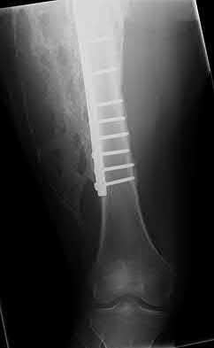 Illustration 203 for OrthoCash: Trauma MCQs & Cases for a yearold woman