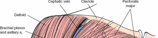 Illustration 8 for Enhance Anterior Shoulder Surgery: Crucial Joint Applied Surgical Anatomy