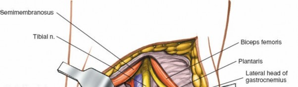 Illustration 191 for Mastering Knee Approaches: Spotlight on Superficial Medial Ligament