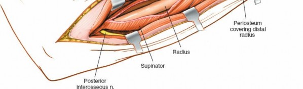 Illustration 73 for Mastering Approaches to the Upper Third of the Radius
