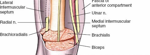 Illustration 12 for Medial Approach to the Distal Humerus: Master Techniques & Avoid Osteotomy