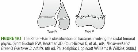 Illustration 12 for Master Pediatric Femoral Shaft & Knee Fractures: Interactive Module