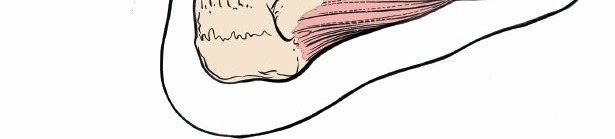 Illustration 67 for Optimized Approaches to the Dorsum of the Foot & Ankle