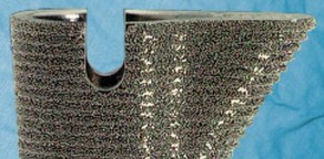 Illustration 5 for S-ROM: Inside the Technique of Modular Implant Design