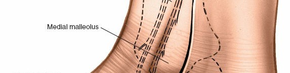 Illustration 2 for Step-by-Step Medial Side of the Ankle Approach Guide