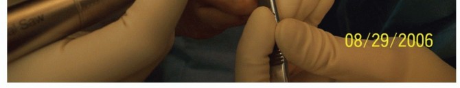 Illustration 26 for Hammer Toe Correction: Understanding the Extensor Digitorum Longus