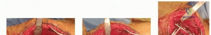 Illustration of brachialis and brachioradialis - Dr. Mohammed Hutaif