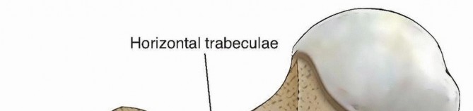 Illustration 4 for Achieve Optimal Femoral Head Fixation with Cephalomedullary Nailing