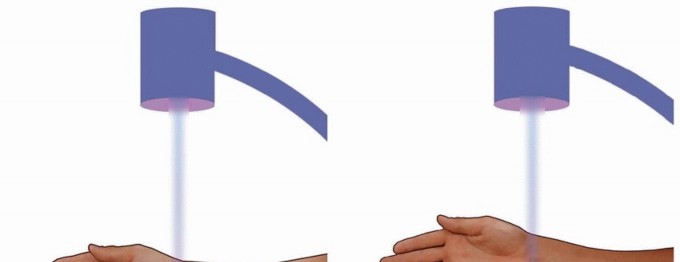 Illustration 8 for Fragment-Specific Fixation: Restore Carpal Facet Horizon