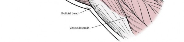 Illustration 69 for Unlocking Every Aspect of the Hip's Surgical Approaches