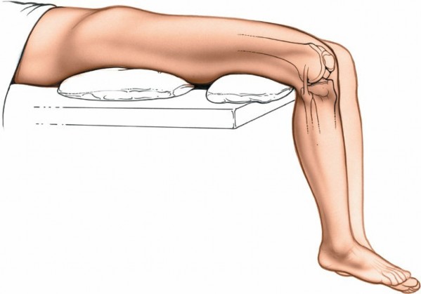 Illustration 133 for Mastering Knee Approaches: Spotlight on Superficial Medial Ligament