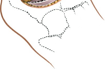 Illustration 104 for Optimized Approaches to the Dorsum of the Foot & Ankle