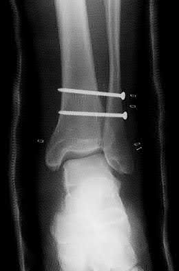 Illustration 52 for OrthoCash: Trauma MCQs & Cases for a yearold woman