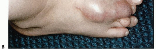 Illustration 5 for Below-Knee Amputation: Maximize Your Below-Knee Recovery & Function