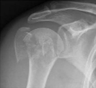 Illustration 74 for OrthoCash: Trauma MCQs & Cases for a yearold woman