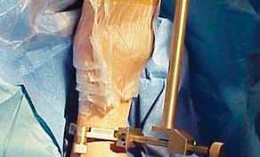 وصف طبي دقيق للمريض