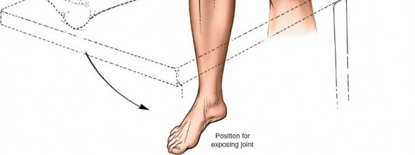 Illustration 29 for Mastering Knee Approaches: Spotlight on Superficial Medial Ligament