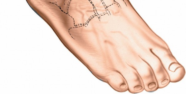 Illustration 102 for Optimized Approaches to the Dorsum of the Foot & Ankle