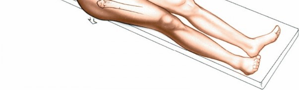 Illustration 100 for Unlocking Every Aspect of the Hip's Surgical Approaches