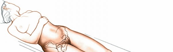 Illustration 99 for Unlocking Every Aspect of the Hip's Surgical Approaches