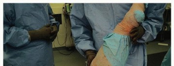 Illustration 30 for Uncemented Acetabular Revision: Optimizing Hemispherical Cup Use