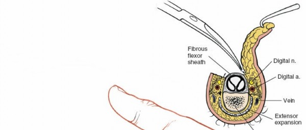 Illustration 147 for Essential Surgical Approaches: Uncover Every Aspect of the Wrist