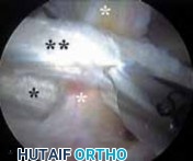 Illustration 30 for J. W. Thomas on Snapping Hip: Causes, Cures & Relief