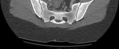 Illustration 190 for OrthoCash: Trauma MCQs & Cases for a yearold woman