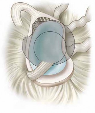 Illustration 2 for Unlock Recovery: Management of Shoulder Throwing Injuries