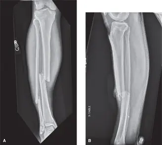متلازمة الحيز الحادة بعد الإصابات: دليل شامل للمرضى مع الأستاذ الدكتور محمد هطيف