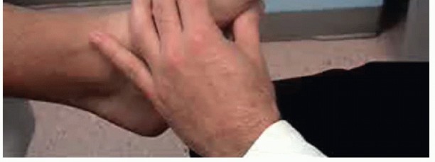 Illustration 55 for End Articular Cartilage Loss: Arthrosurface HemiCAP Resurfacing