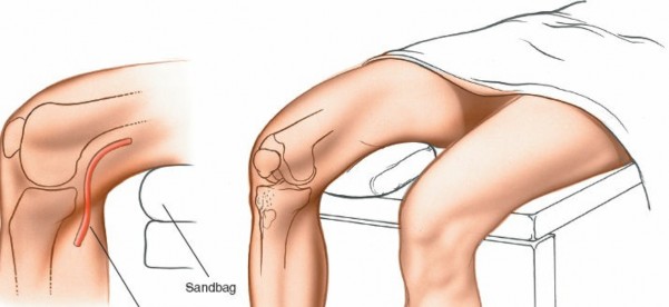 Illustration of approach for medial - Dr. Mohammed Hutaif