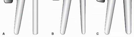 Illustration 2 for Why Double-Tapered Primary Stems Deliver Lasting Stability