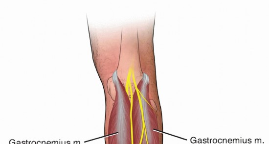Illustration of gastrocnemius and soleus - Dr. Mohammed Hutaif