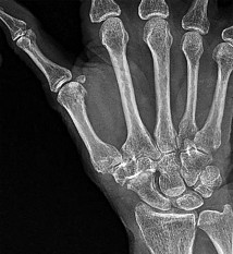 صورة طبية: دليل الأستاذ الدكتور محمد هطيف الشامل لأمراض وإصابات اليد والمعصم في صنعاء