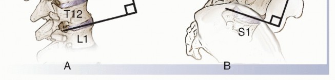 Illustration 17 for Adult Scoliosis: Uncover Causes & Find Lasting Back Pain Relief