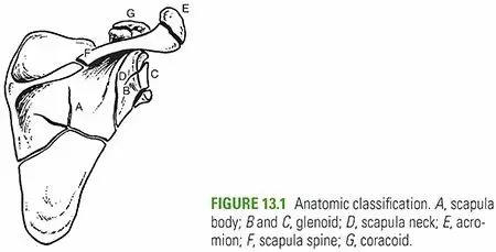 صورة توضيحية لـ كسور لوح الكتف: دليلك الشامل لاستعادة صحة كتفك وحركته مع الأستاذ الدكتور محمد هطيف