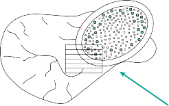 Illustration 56 for Mastering Short External Rotators for Optimal Hip Surgery Results