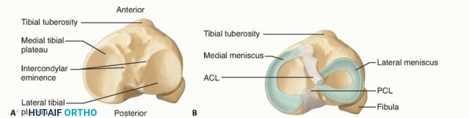Illustration 4 for Treating Tibial Spine Fractures: Arthroscopy or Open Reduction?