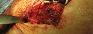 Illustration 66 for Figure Hip Resurfacing: Who Benefits and Who Should Avoid It?