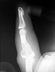 وصف طبي دقيق ومبسط للمريض