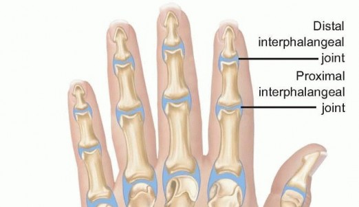Surgical Treatment of Septic Arthritis in the Hand and Wrist