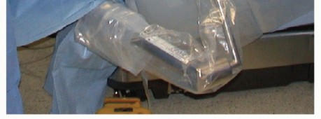 Illustration 12 for Glenoid Bone Graft for Anterior Shoulder Instability: Restore Stability